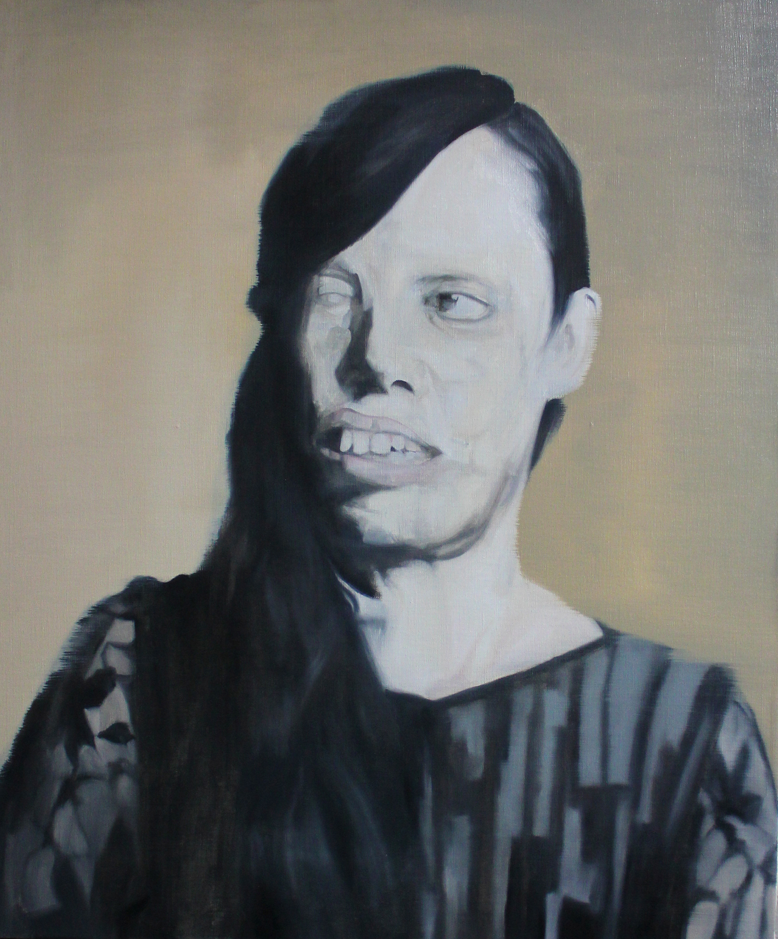 Acid Attack Victim (6)